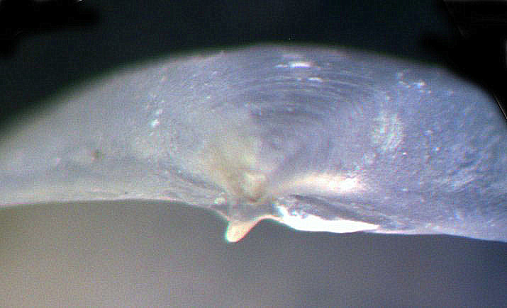 Saxicavella jeffreysi o Basterotia angulata?